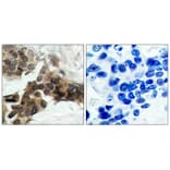 Immunohistochemistry - IkB-a (Phospho-Ser32/Ser36) Antibody from Signalway Antibody (11152) - Antibodies.com