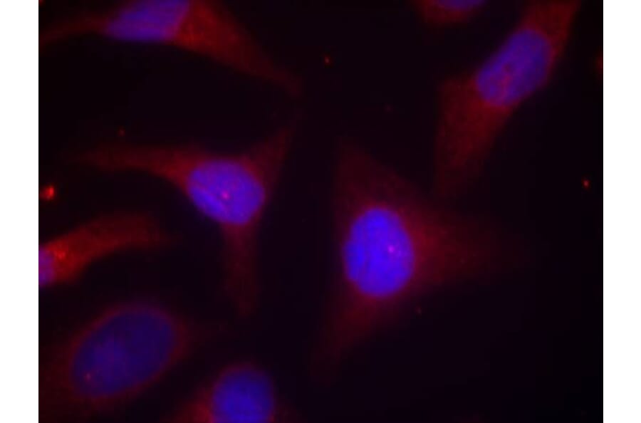 Immunofluorescence - IkB-a (Phospho-Ser32/Ser36) Antibody from Signalway Antibody (11152) - Antibodies.com