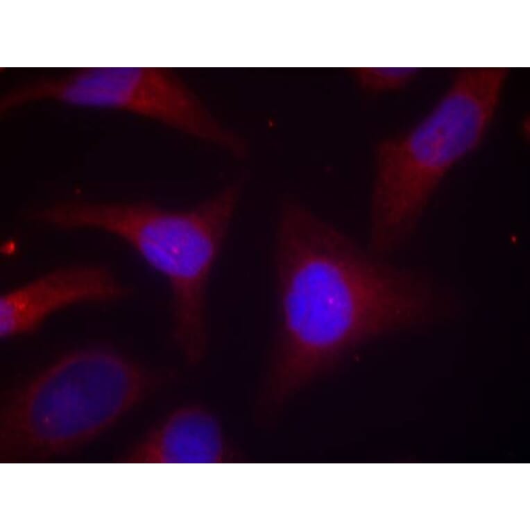 Immunofluorescence - IkB-a (Phospho-Ser32/Ser36) Antibody from Signalway Antibody (11152) - Antibodies.com