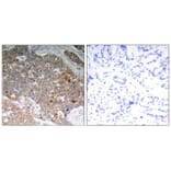 Immunohistochemistry - GSK3α/β (Phospho-Tyr279/216) Antibody from Signalway Antibody (11301) - Antibodies.com