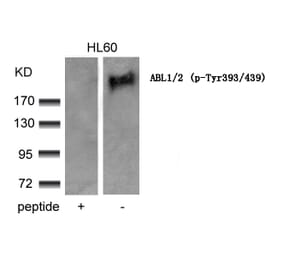 Western blot - ABL1/2 (phospho-Tyr393/439) Antibody from Signalway Antibody (11530) - Antibodies.com
