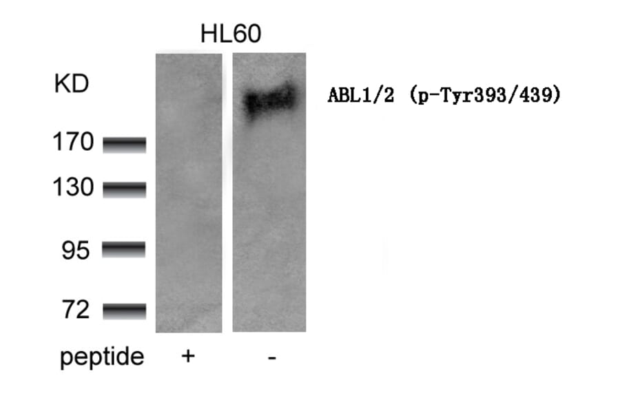 Western blot - ABL1/2 (phospho-Tyr393/439) Antibody from Signalway Antibody (11530) - Antibodies.com