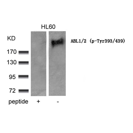 Western blot - ABL1/2 (phospho-Tyr393/439) Antibody from Signalway Antibody (11530) - Antibodies.com