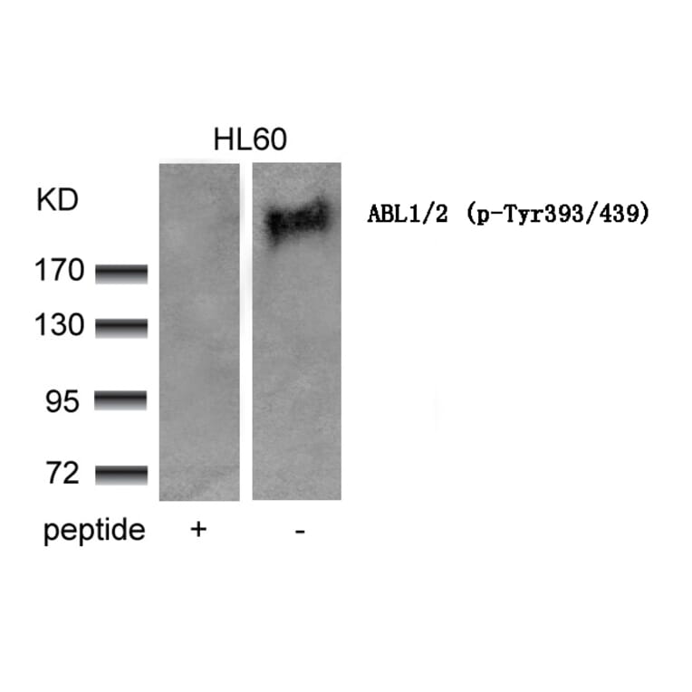 Western blot - ABL1/2 (phospho-Tyr393/439) Antibody from Signalway Antibody (11530) - Antibodies.com