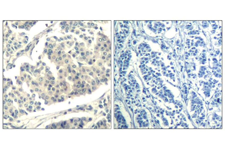 Immunohistochemistry - ABL1/2 (phospho-Tyr393/439) Antibody from Signalway Antibody (11530) - Antibodies.com
