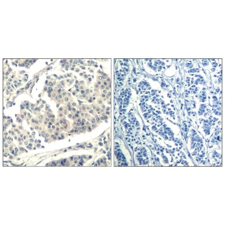 Immunohistochemistry - ABL1/2 (phospho-Tyr393/439) Antibody from Signalway Antibody (11530) - Antibodies.com