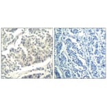 Immunohistochemistry - ABL1/2 (phospho-Tyr393/439) Antibody from Signalway Antibody (11530) - Antibodies.com