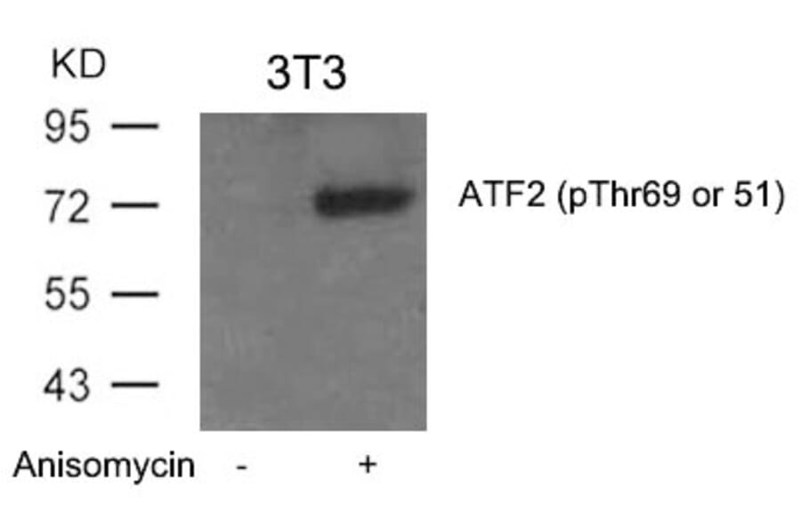 Western blot - ATF2 (Phospho-Thr69 or 51) Antibody from Signalway Antibody (11030) - Antibodies.com