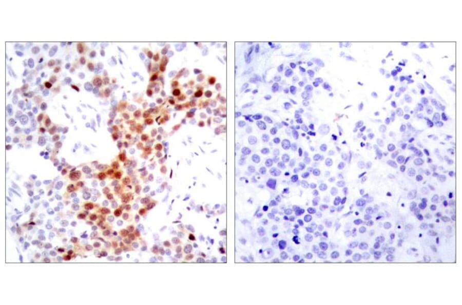 Immunohistochemistry - ATF2 (Phospho-Thr69 or 51) Antibody from Signalway Antibody (11030) - Antibodies.com