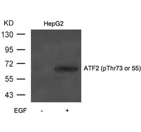 Western blot - ATF2 (Phospho-Thr73 or 55) Antibody from Signalway Antibody (11032) - Antibodies.com