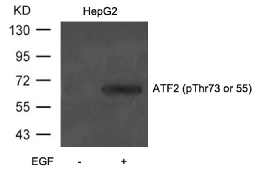 Western blot - ATF2 (Phospho-Thr73 or 55) Antibody from Signalway Antibody (11032) - Antibodies.com