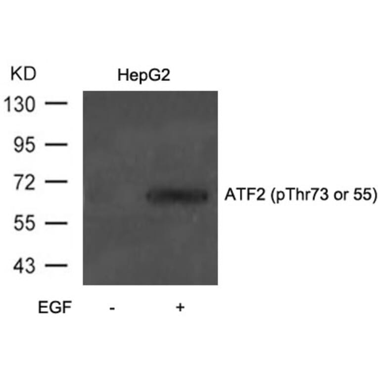 Western blot - ATF2 (Phospho-Thr73 or 55) Antibody from Signalway Antibody (11032) - Antibodies.com