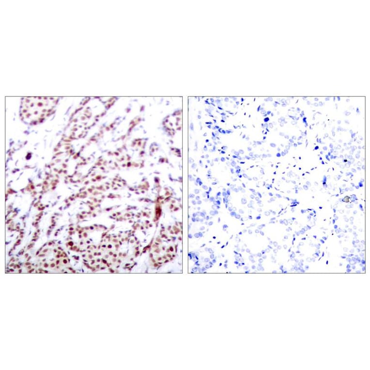 Immunohistochemistry - ATF2 (Phospho-Thr73 or 55) Antibody from Signalway Antibody (11032) - Antibodies.com