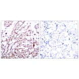 Immunohistochemistry - ATF2 (Phospho-Thr73 or 55) Antibody from Signalway Antibody (11032) - Antibodies.com