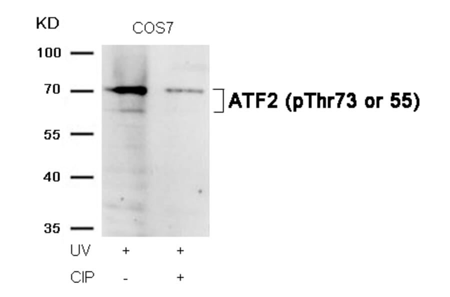 Western blot - ATF2 (Phospho-Thr73 or 55) Antibody from Signalway Antibody (11032) - Antibodies.com