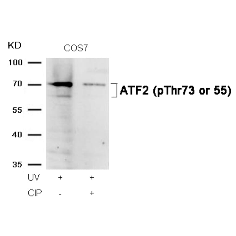 Western blot - ATF2 (Phospho-Thr73 or 55) Antibody from Signalway Antibody (11032) - Antibodies.com