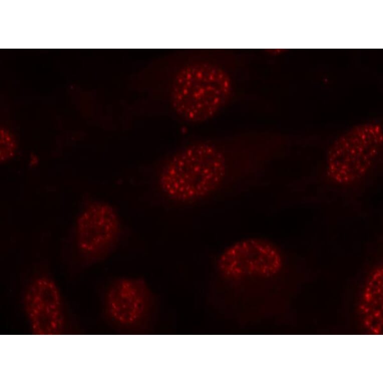 Immunofluorescence - MAPKAPK-2 (Phospho-Thr334) Antibody from Signalway Antibody (11308) - Antibodies.com