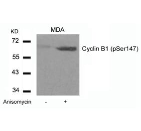 Western blot - Cyclin B1 (phospho-Ser147) Antibody from Signalway Antibody (11540) - Antibodies.com