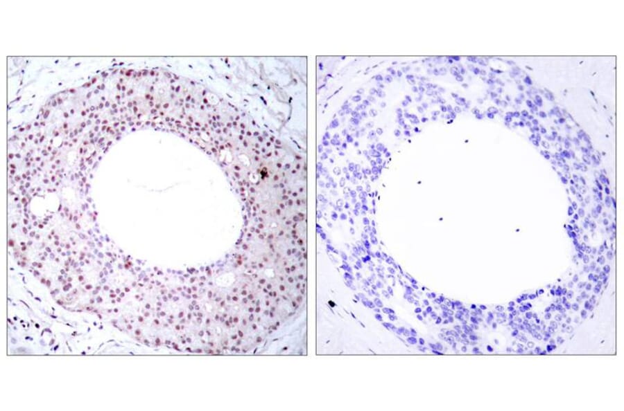 Immunohistochemistry - NFkB-p65 (Phospho-Thr254) Antibody from Signalway Antibody (11010) - Antibodies.com