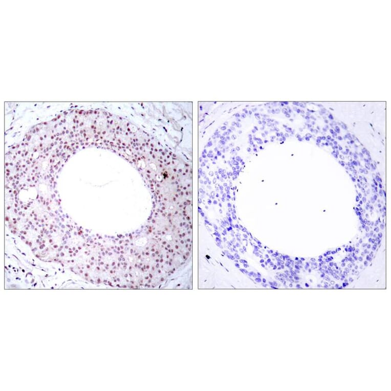 Immunohistochemistry - NFkB-p65 (Phospho-Thr254) Antibody from Signalway Antibody (11010) - Antibodies.com