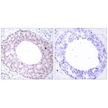 Immunohistochemistry - NFkB-p65 (Phospho-Thr254) Antibody from Signalway Antibody (11010) - Antibodies.com