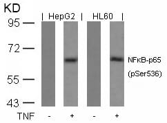 Anti-NFkB-p65 (Phospho-Ser536) Antibody (A50150) | Antibodies.com