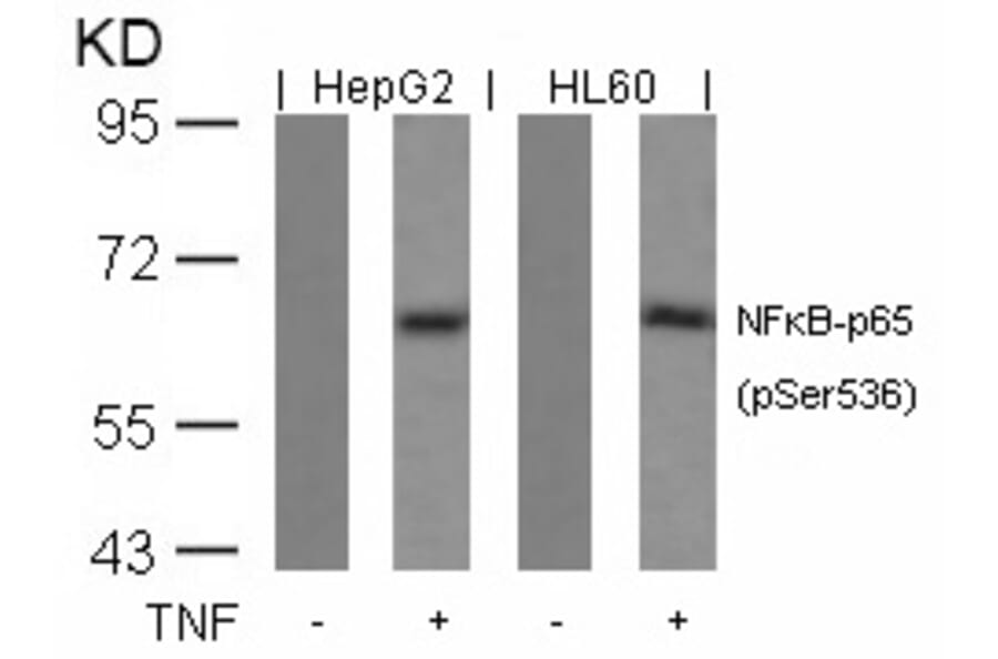 Western blot - NFkB-p65 (Phospho-Ser536) Antibody from Signalway Antibody (11014) - Antibodies.com
