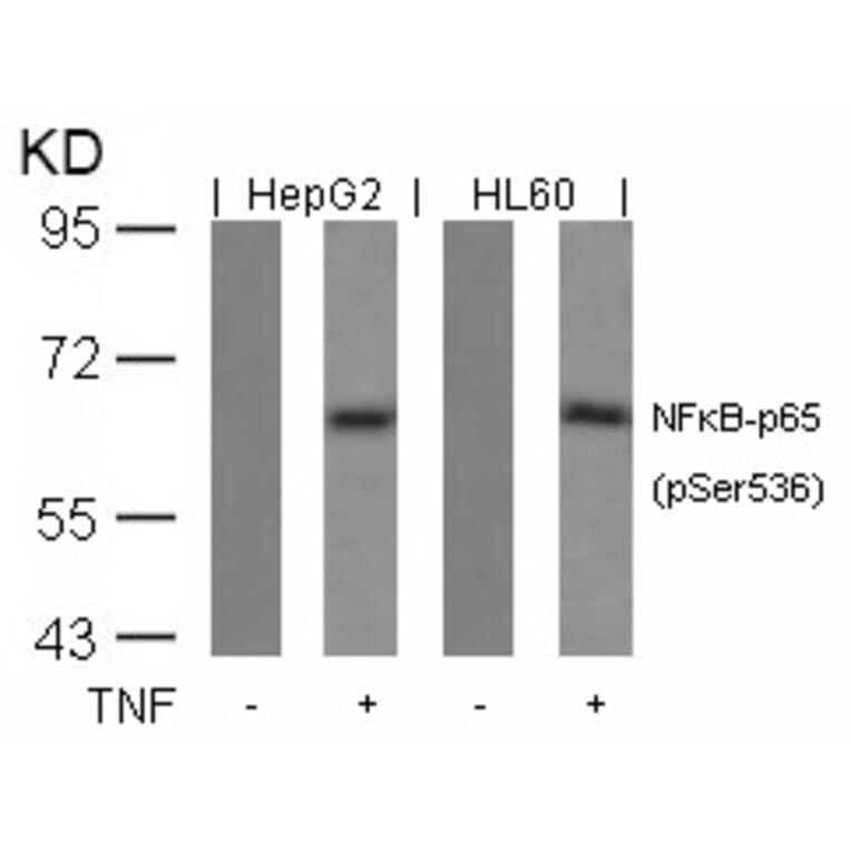 Western blot - NFkB-p65 (Phospho-Ser536) Antibody from Signalway Antibody (11014) - Antibodies.com