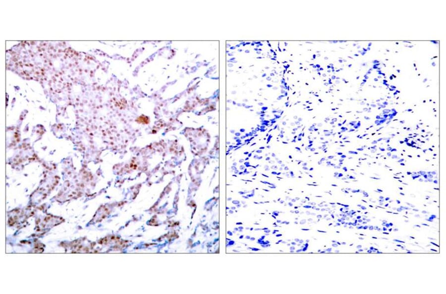 Immunohistochemistry - NFkB-p65 (Phospho-Ser536) Antibody from Signalway Antibody (11014) - Antibodies.com