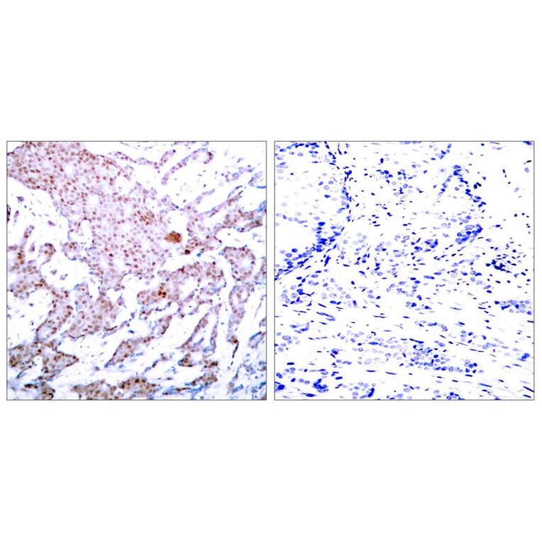 Immunohistochemistry - NFkB-p65 (Phospho-Ser536) Antibody from Signalway Antibody (11014) - Antibodies.com