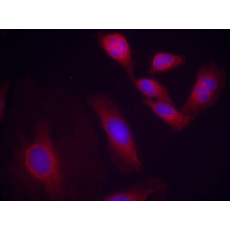 Immunofluorescence - NFkB-p65 (Phospho-Ser536) Antibody from Signalway Antibody (11014) - Antibodies.com