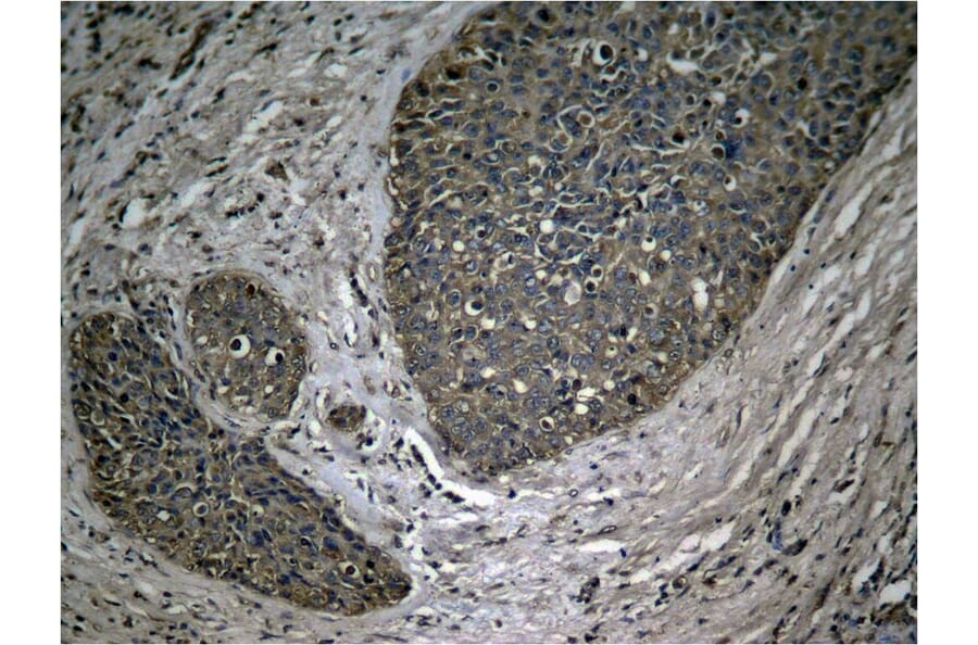 Immunohistochemistry - NFkB-p65 (Phospho-Ser536) Antibody from Signalway Antibody (11014) - Antibodies.com