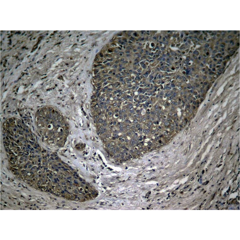 Immunohistochemistry - NFkB-p65 (Phospho-Ser536) Antibody from Signalway Antibody (11014) - Antibodies.com