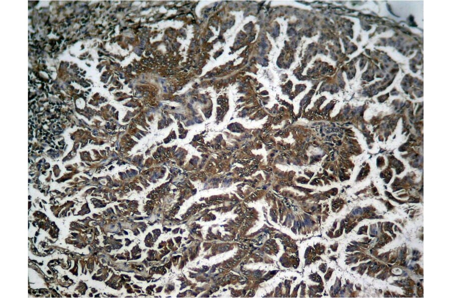 Immunohistochemistry - NFkB-p65 (Phospho-Ser536) Antibody from Signalway Antibody (11014) - Antibodies.com