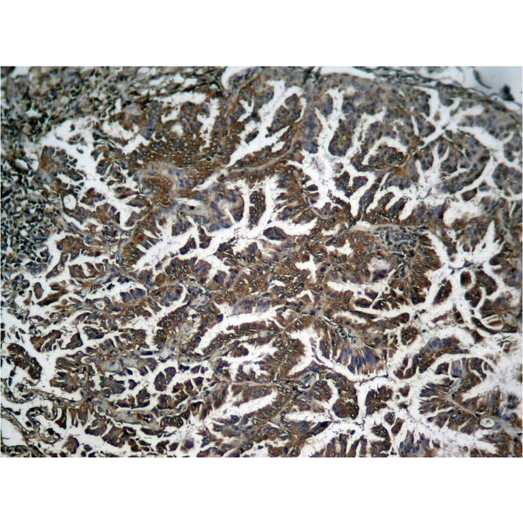 Immunohistochemistry - NFkB-p65 (Phospho-Ser536) Antibody from Signalway Antibody (11014) - Antibodies.com