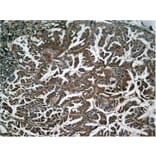 Immunohistochemistry - NFkB-p65 (Phospho-Ser536) Antibody from Signalway Antibody (11014) - Antibodies.com