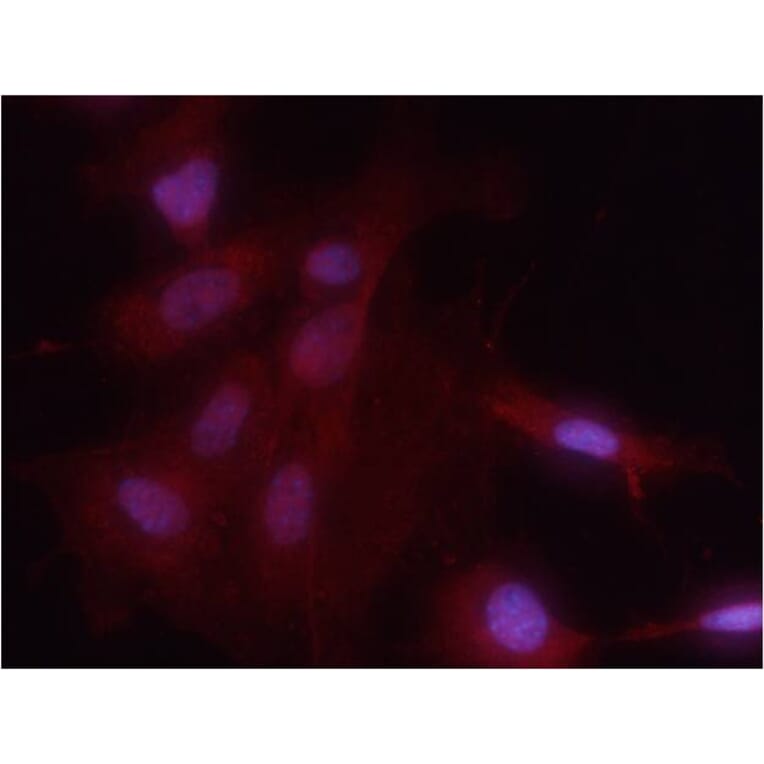 Immunofluorescence - NFkB-p65 (Phospho-Ser536) Antibody from Signalway Antibody (11014) - Antibodies.com