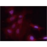 Immunofluorescence - NFkB-p65 (Phospho-Ser536) Antibody from Signalway Antibody (11014) - Antibodies.com