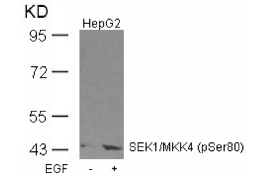 Western blot - SEK1/MKK4 (Phospho-Ser80) Antibody from Signalway Antibody (11177) - Antibodies.com