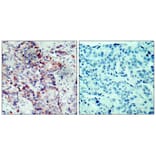 Immunohistochemistry - SEK1/MKK4 (Phospho-Ser80) Antibody from Signalway Antibody (11177) - Antibodies.com