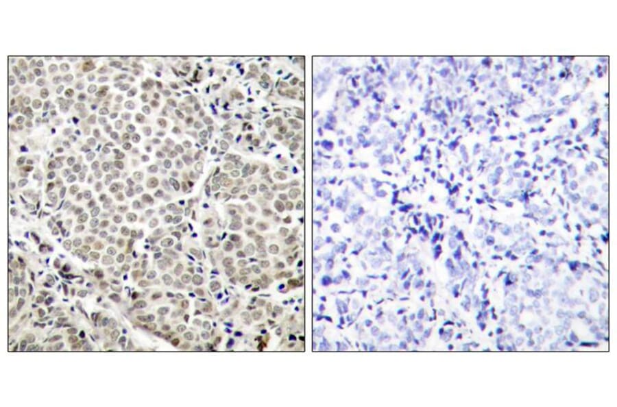 Immunohistochemistry - NFkB-p65 (Phospho-Ser529) Antibody from Signalway Antibody (11217) - Antibodies.com