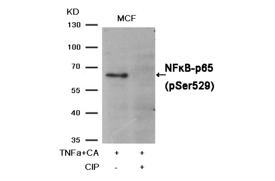 Western blot - NFkB-p65 (Phospho-Ser529) Antibody from Signalway Antibody (11217) - Antibodies.com