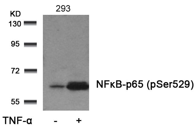 Anti-NFkB-p65 (Phospho-Ser529) Antibody (A50152) | Antibodies.com