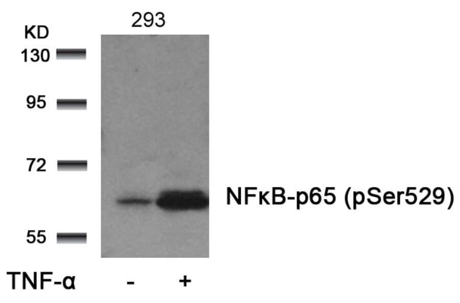 Western blot - NFkB-p65 (Phospho-Ser529) Antibody from Signalway Antibody (11217) - Antibodies.com