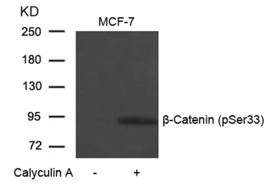 Western blot - b-Catenin (Phospho-Ser33) Antibody from Signalway Antibody (11218) - Antibodies.com