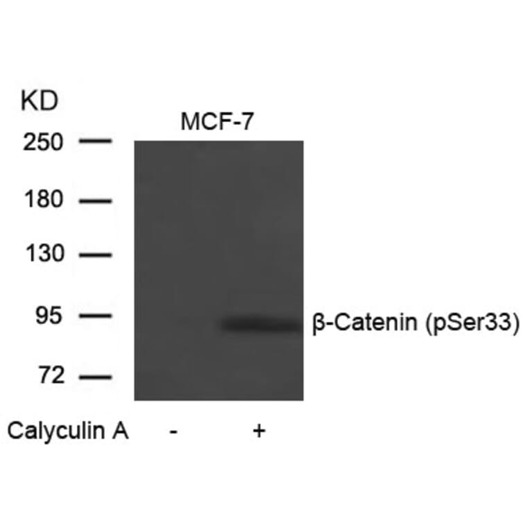 Western blot - b-Catenin (Phospho-Ser33) Antibody from Signalway Antibody (11218) - Antibodies.com