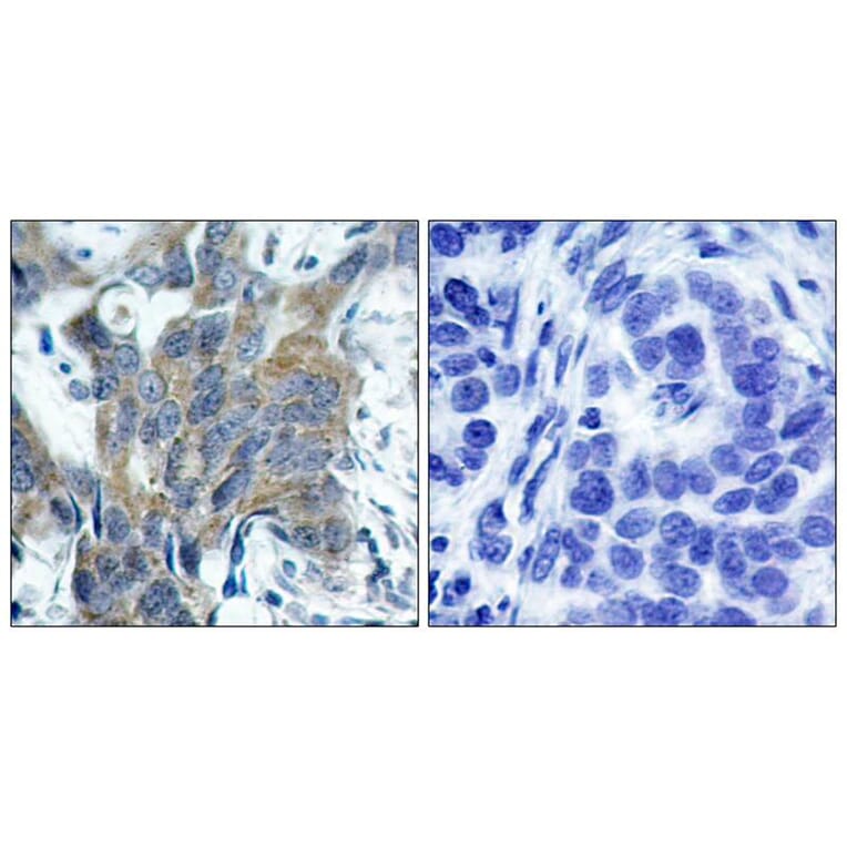 Immunohistochemistry - b-Catenin (Phospho-Ser33) Antibody from Signalway Antibody (11218) - Antibodies.com