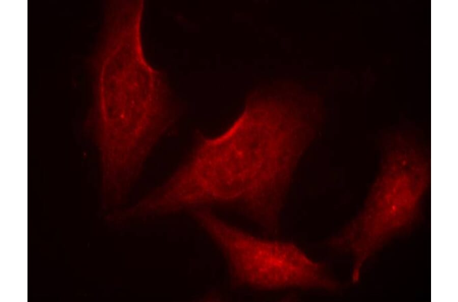 Immunofluorescence - NFκB-p65 (phospho-Ser311) Antibody from Signalway Antibody (11260) - Antibodies.com