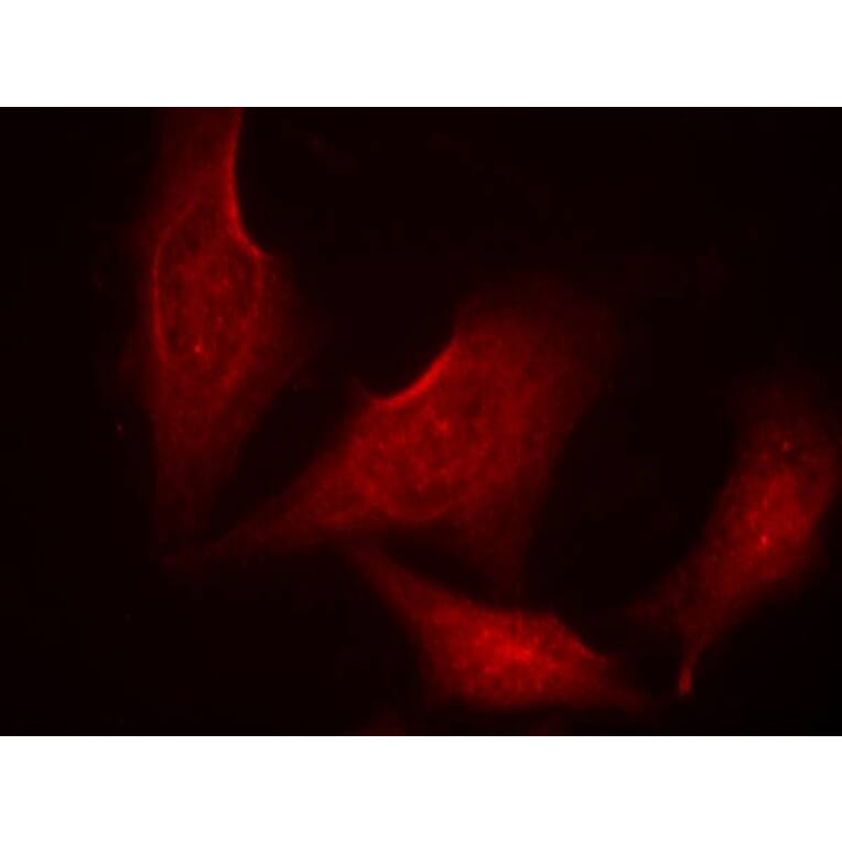 Immunofluorescence - NFκB-p65 (phospho-Ser311) Antibody from Signalway Antibody (11260) - Antibodies.com