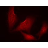 Immunofluorescence - NFκB-p65 (phospho-Ser311) Antibody from Signalway Antibody (11260) - Antibodies.com